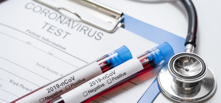 Αυγερινοπούλου προς Σταϊκούρα και Τριαντόπουλο, ΓΓ Υπ. Οικονομικών: Επώδυνες οι Επιπτώσεις του COVID-19 στην τοπική οικονομία.   Πρόσθετη στήριξη στην οικονομία του Ν. Ηλείας – Τα μέτρα για την Ηλεία δεν αρκούν